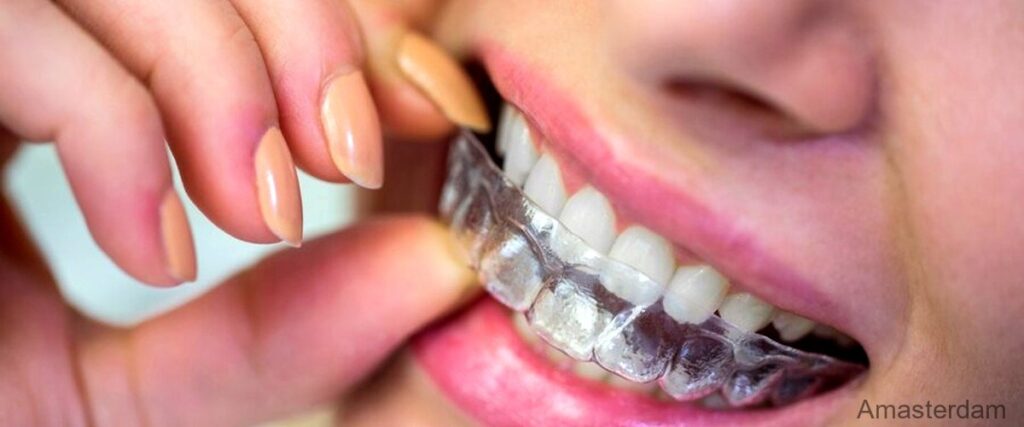 De 7 Beste Orthodontisten in Amsterdam